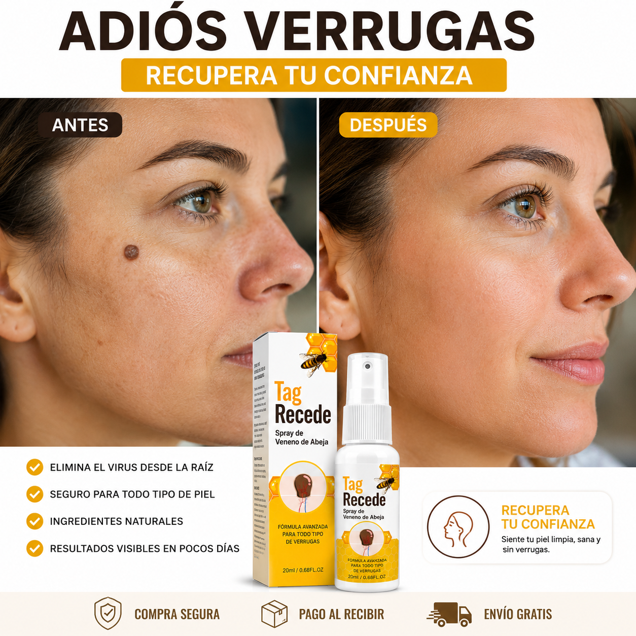 🐝 BeeClear Spray de Veneno de Abeja — Elimina verrugas al instante + ENVÍO GRATIS ✨