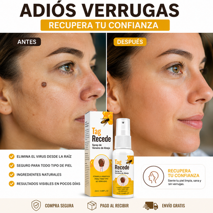 🐝 BeeClear Spray de Veneno de Abeja — Elimina verrugas al instante + ENVÍO GRATIS ✨