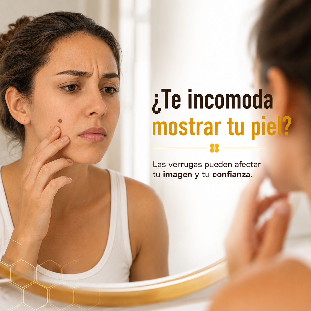 🐝 BeeClear Spray de Veneno de Abeja — Elimina verrugas al instante + ENVÍO GRATIS ✨