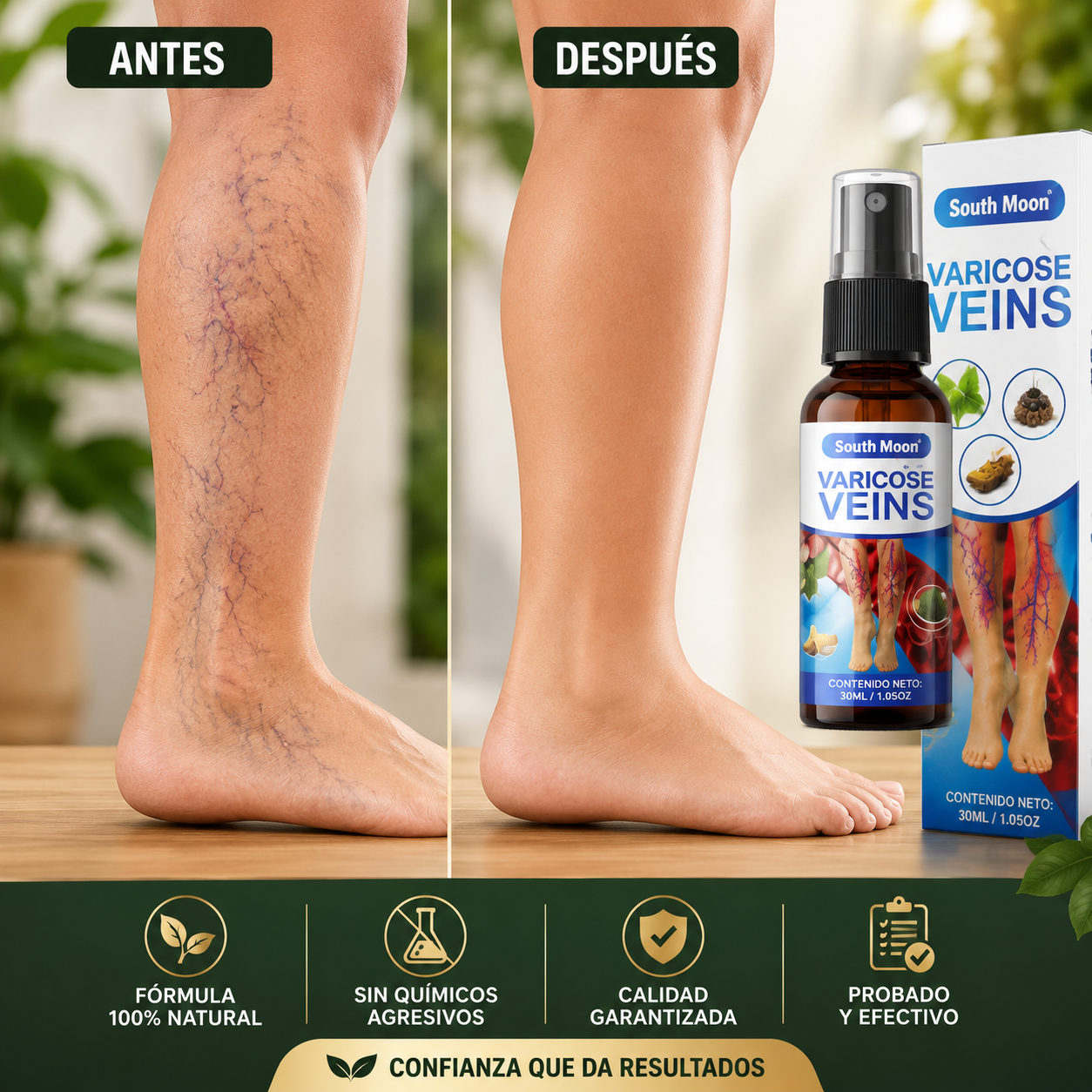 💙 South Moon™ Spray para Varices — Recupera la confianza en tus piernas ✨